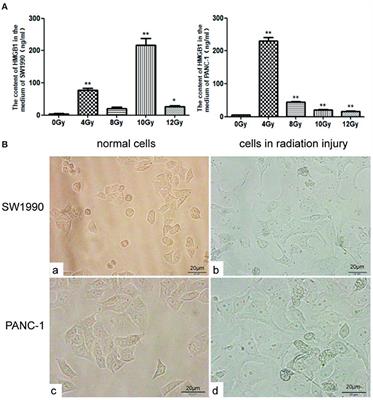 Exogenous HMGB1 Promotes the Proliferation and Metastasis of Pancreatic Cancer Cells